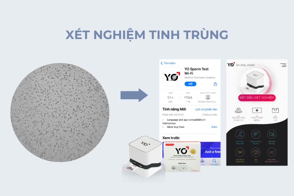 Sử dụng máy xét nghiệm tinh trùng Yo Sperm Test là sự lựa chọn của nhiều ba mẹ