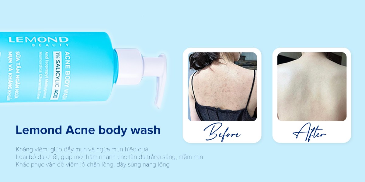 Hình ảnh trước và sau khi sử dụng sữa tắm Lemond Acne Body Wash