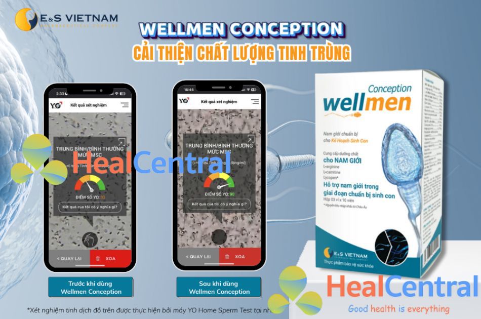 Wellmen Conception