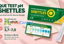 Que test môi trường kiềm nào chính xác, bảng màu chuẩn? Que thử môi trường kiềm Shettles